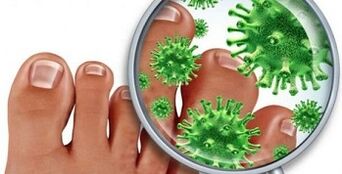 How to treat a fungal infection on the finger