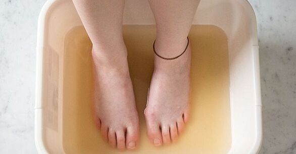 Iodine bath for treating nail fungus
