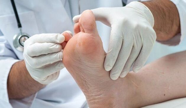 Treatment and diagnosis of fungus by a doctor