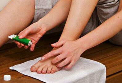 Applying an ointment to treat toenail fungus