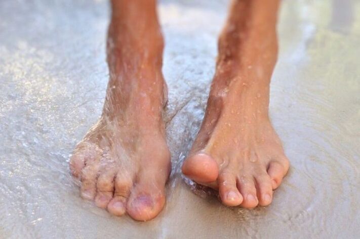 Walking barefoot is one way to get nail fungus